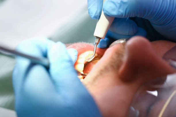 Best Emergency Treatment for Toothache in Edgerton, OH